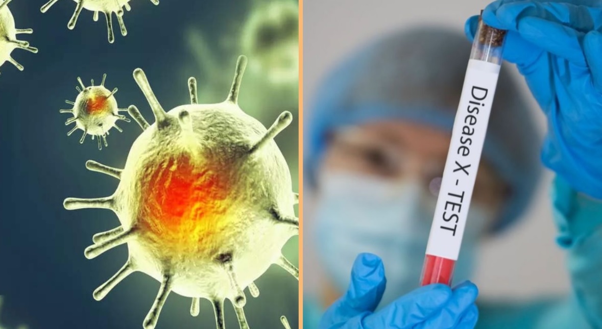 'Disease X' Could be 20 Times Deadlier Than COVID-19 ,What is it And Why Scientists are Worried About its Spread?